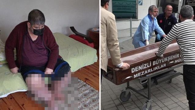 Dayanacak gücüm kalmadı diyen fil ayağı hastası Karaoğlanoğlu, yaşamını yitirdi