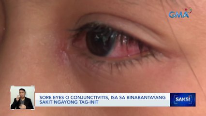 Sore eyes o conjunctivitis, isa sa binabantayang sakit ngayong tag-init | Saksi