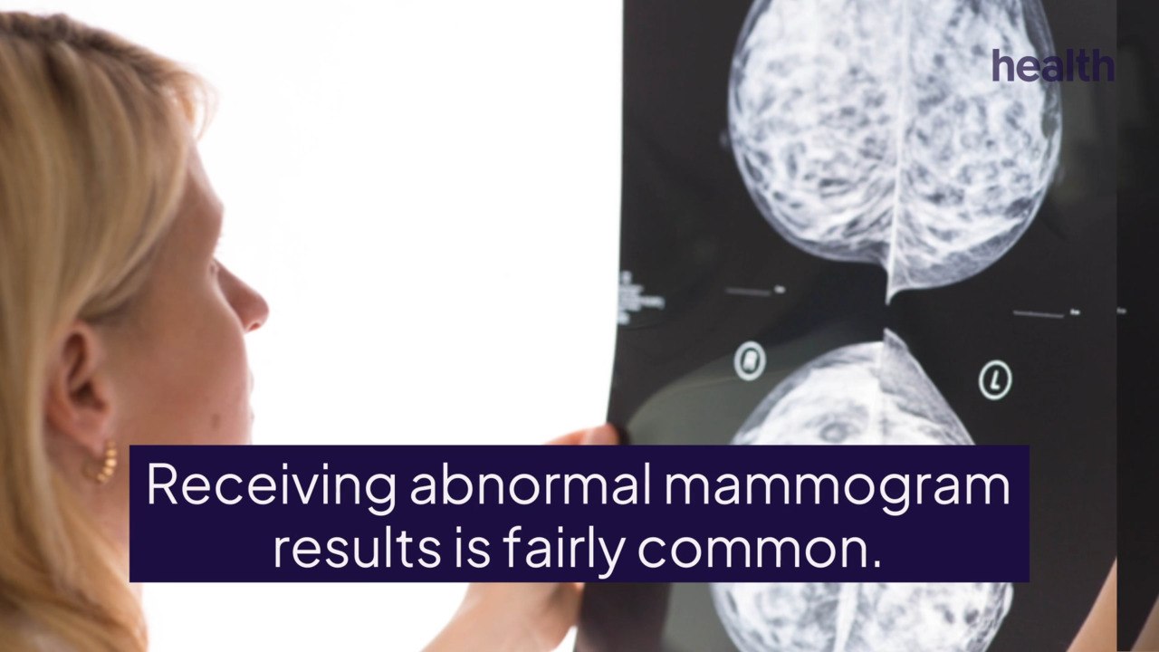 Follow-Up Breast Cancer Imaging Costs Deter People From Getting Care, Study Finds