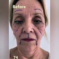 74 yaşındaki bir kadının estetik operasyonlarla 30 yaş daha genç görünmeyi başarması