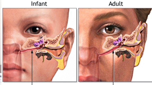 band kaan kaise khole | unclog your clogged ear in Urdu/hindi@rahmancare