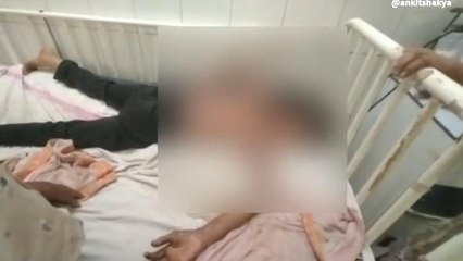 शिवपुरी: आग की चपेट में आकर मासूम बुरी तरह झुलसी, अस्पताल में उपचार जारी