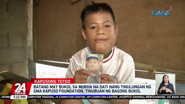 Batang may bukol sa mukha na dati nang tinulungan ng GMA Kapuso Foundation, tinubuan ng bagong bukol | 24 Oras