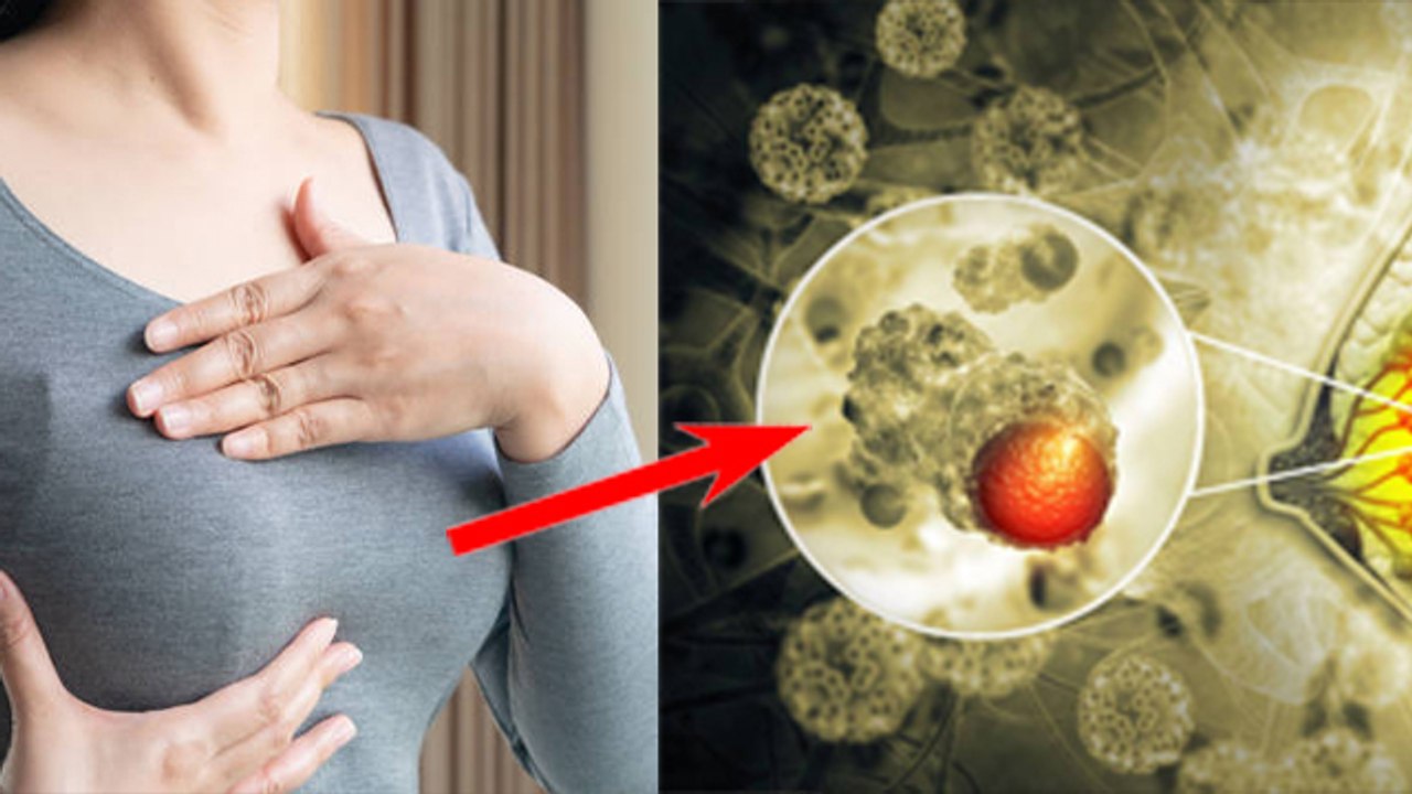 Inflammatory Breast Cancer क्या है, Symptoms और Reason चौकाने वाला |Boldsky