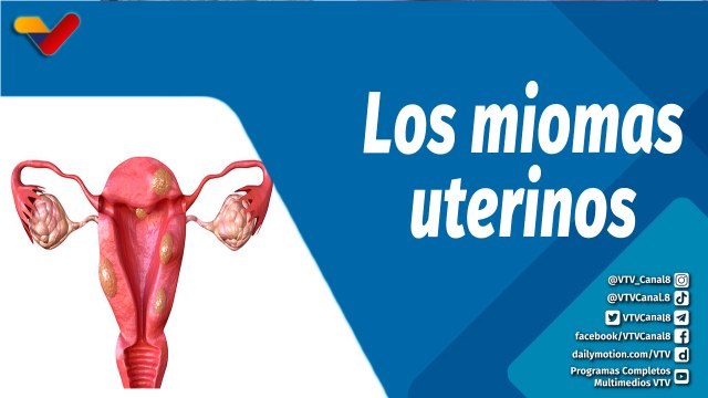 Actitud Saludable | Qué son los miomas uterinos y cómo tratarlos