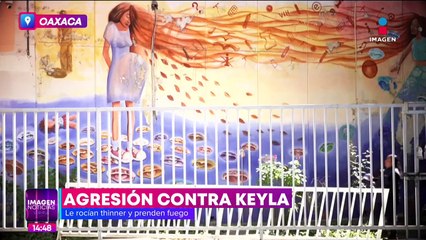 Keyla fue rociada con thinner por un hombre quien después le prendió fuego