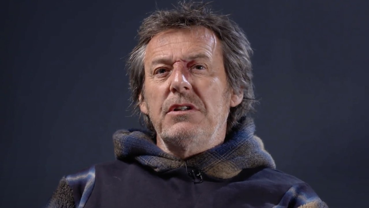 Jean-Luc Reichmann évoque sa tache : "Quand tu es à l’école, c'est assez cruel, quand tu es ado c'est insupportable"