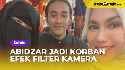 Abidzar Jadi Korban Efek Filter Kamera Jahat Emak-emak: Jadi Cantik Banget
