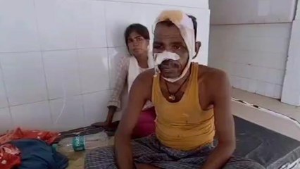 पूर्णिया: दो व्यक्तियों के बीच हो रही लड़ाई को छुड़ाना पड़ा महंगा