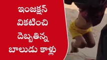 ములుగు: ఇంజక్షన్ వికటించి దెబ్బతిన్న బాలుడు కాళ్లు