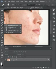 Remove blemishes in Photoshop