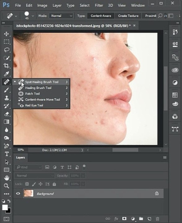 Remove blemishes in Photoshop