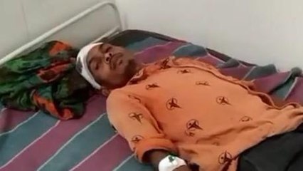 सीधी: आपसी रंजिश के चलते युवक की हुई बेरहमी से पिटाई, ज़ारी ईलाज