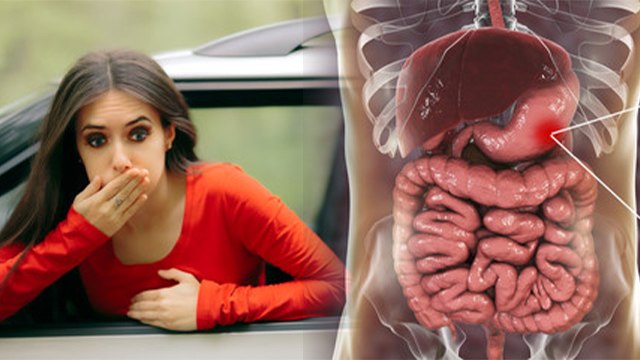 सफर के समय उलटी क्यों होती है | Safar Ke Time Ulti Kyu Hoti Hai | Motion Sickness Reason