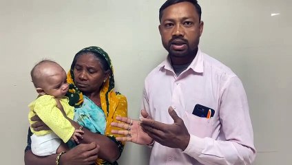 Video..... अहमदाबाद सिविल अस्पताल में दुर्लभ मामला, बच्चे का 95 फीसदी मुंह घेरे हुए थी गांठ