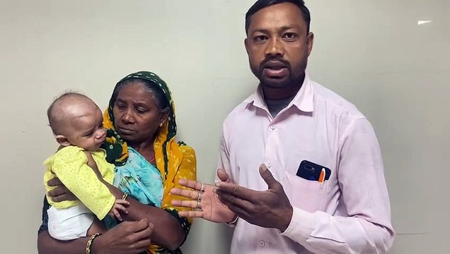 Video..... अहमदाबाद सिविल अस्पताल में दुर्लभ मामला, बच्चे का 95 फीसदी मुंह घेरे हुए थी गांठ