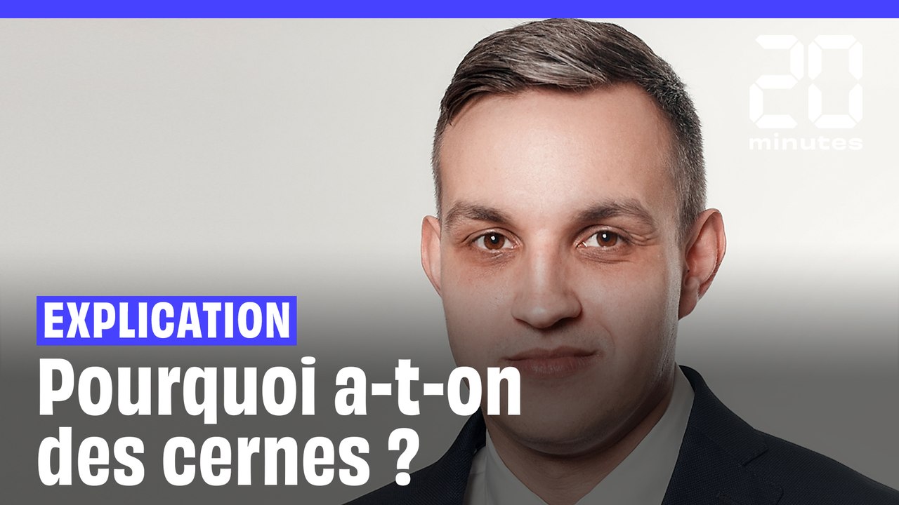 Pourquoi a-t-on des cernes ?