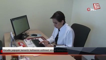 Vücuda yapışan kenenin kafasının ezilmesi virüsü bulaştırıyor