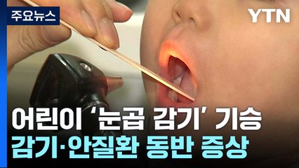 [뉴스라이더] 눈곱 감기에 꽃가루까지...호흡기 건강 주의보 / YTN