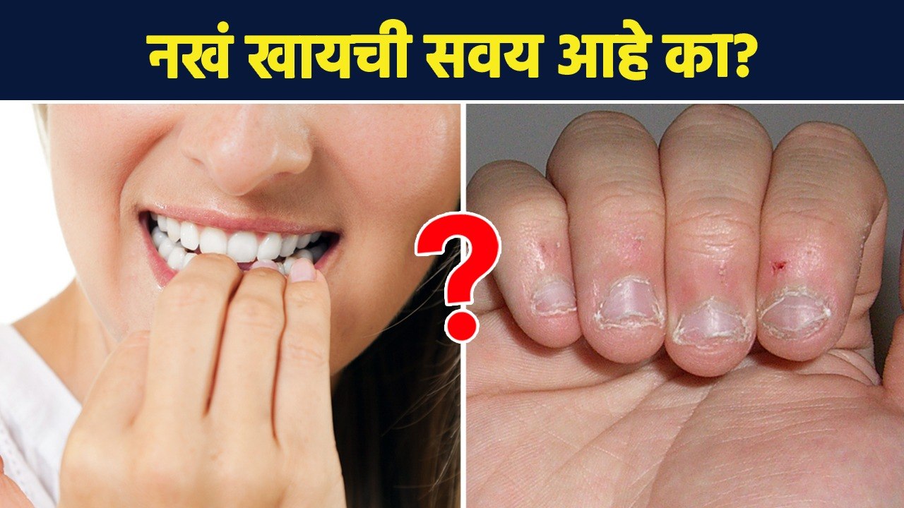 नखं खायची सवय ठरू शकते घातक?  | How to Stop Biting your Nails | Nail Biting Habit | Lokmat Sakhi AI2