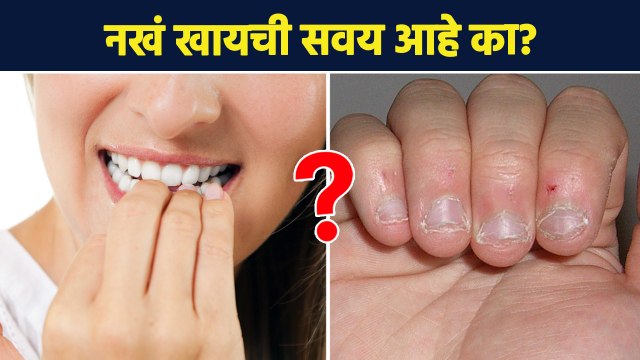 नखं खायची सवय ठरू शकते घातक? | How to Stop Biting your Nails | Nail Biting Habit | Lokmat Sakhi AI2