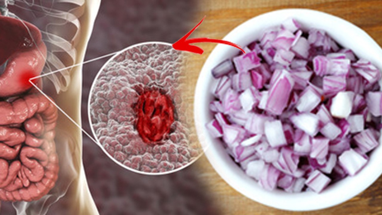 रोज कच्चा प्याज खाने से क्या होता है | Roj Kaccha Pyaaj Khane Se Kya Hota Hai |Boldsky