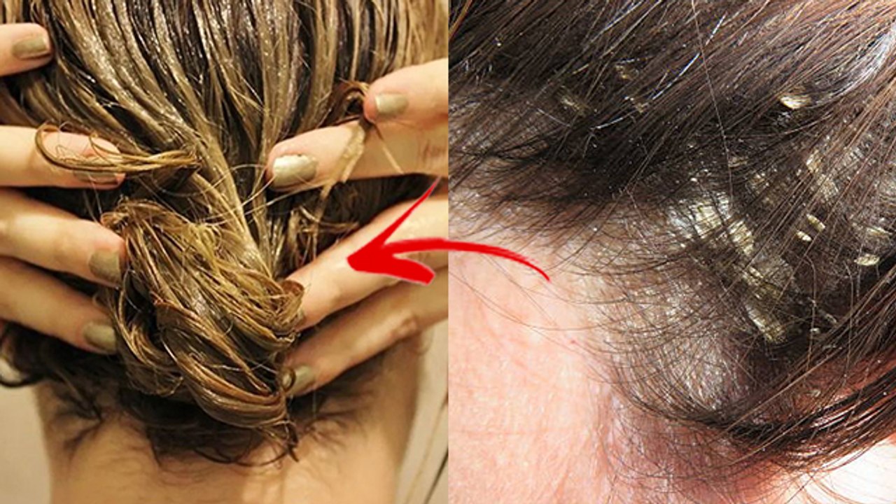 गर्मी में बालों पर मुल्तानी मिट्टी लगाने से क्या होता है । बालों पर मुल्तानी मिट्टी लगाने के फायदे ।