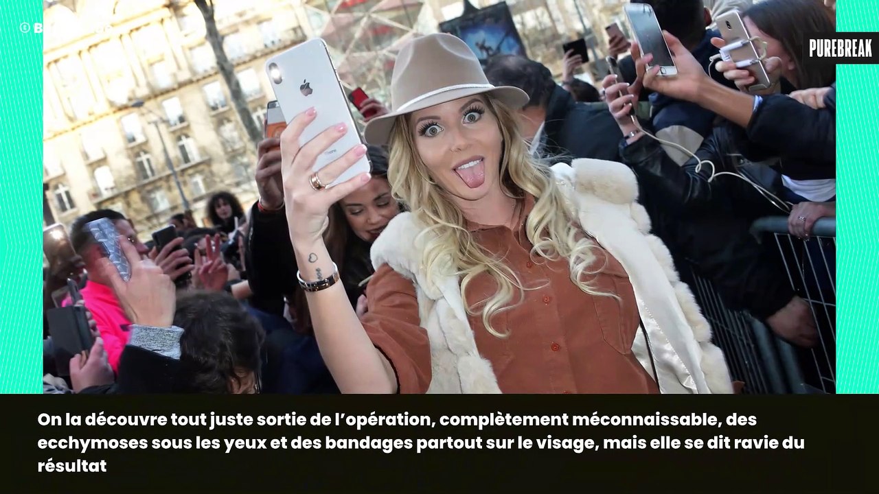 Le chirurgien de Jessica Thivenin dévoile son avant/après chirurgie et la différence est flagrante