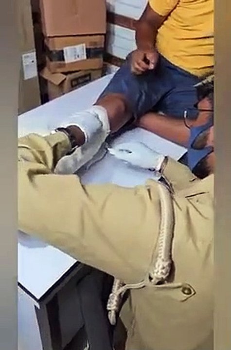 Gold Thief in Dubai Caught with a Broken Leg - Police Uncover Shocking New Smuggling Tactic!