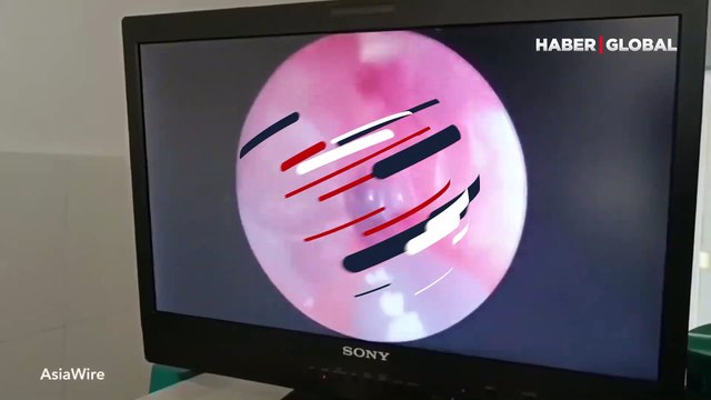 Kulak uğuldaması şikayetiyle doktora başvurdu! Gerçeği öğrenince büyük şok yaşadı