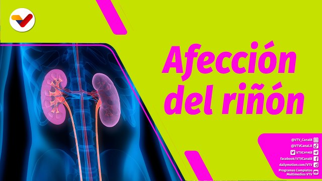 Buena Vibra | ¿Cuáles son las afecciones más comunes en el riñón?