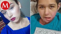 Joven fue víctima de intento de feminicidio en Nuevo León y sus agresores siguen libres