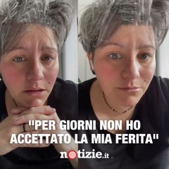 "Per giorni non ho accettato la mia ferita"