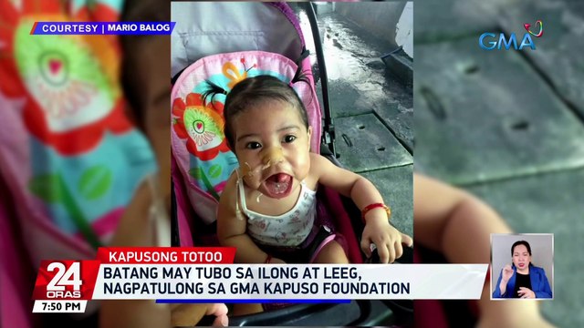 Batang may tubo sa ilong at leeg, nagpatulong sa GMA Kapuso Foundation | 24 Oras