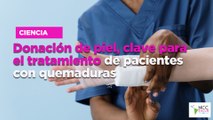 Donación de piel, clave para el tratamiento de pacientes con quemaduras