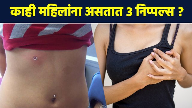 निप्पलबद्दलच्या या गोष्टी कधीच ऐकल्या नसतील | Facts About Nipples | Fluid Leak |Inverted Nipple |RI2