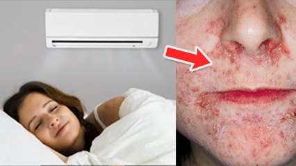 AC के बिना नींद नहीं आना Skin Allergy से लेकर Lung Congestion का खतरा | Boldsky