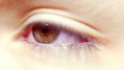 SÍNDROME DO OLHO SECO É PROBLEMA SÉRIO..