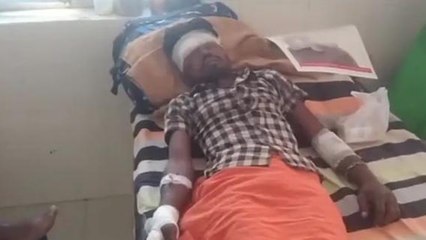 सीधी: भीषण सड़क हादसे में बाइक चालक हुआ गंभीर रूप से घायल, अस्पताल में चल रहा है इलाज