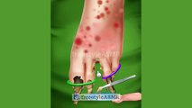 ASMR Foot Surgery Removal of Planter Warts, and Fungal Infection Treatment | #amsr #animation
