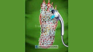 ASMR Foot Surgery Removal of Maggots, and Fungal Infection Treatment | #amsr #animation