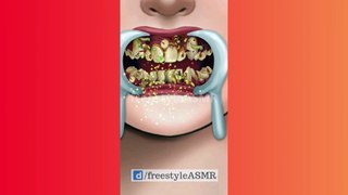 ASMR Dental Treatment and Beautification | #amsr #animation