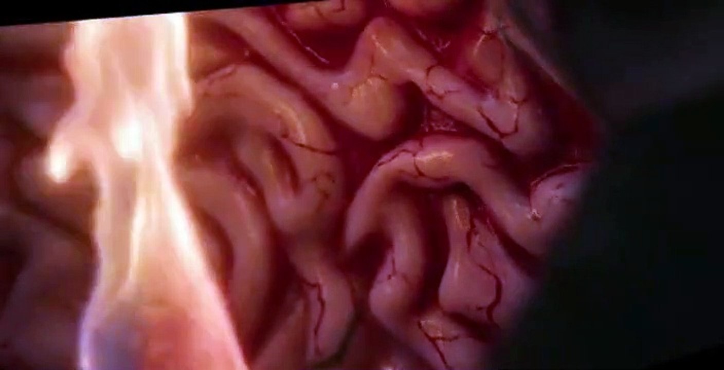 Hot Skull S01 E04