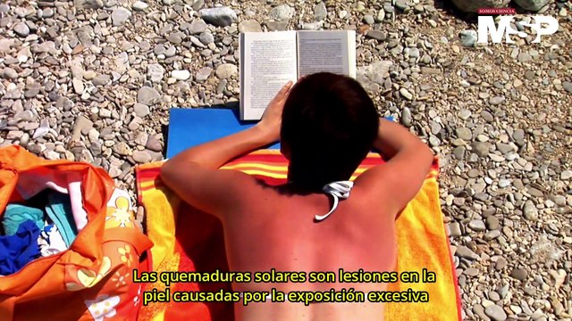 Quemaduras solares: ¿Por qué se quema la #piel? - #ExclusivoMSP