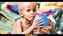 Mind-blowing news, Pakistan, a country suffering from malnutrition | Public News | Breaking News | Pakistan Breaking News