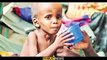 Mind-blowing news, Pakistan, a country suffering from malnutrition | Public News | Breaking News | Pakistan Breaking News