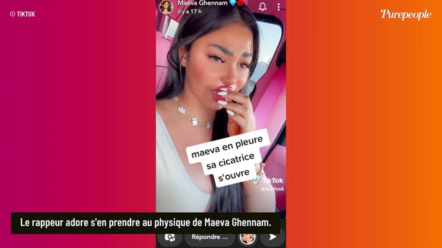 Maeva Ghennam : Sa chirurgie esthétique vire au cauchemar, sa lèvre supérieure est trop lourde !