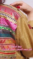 ريم أرحمة قبل وبعد التجميل بسبب الاكتئاب