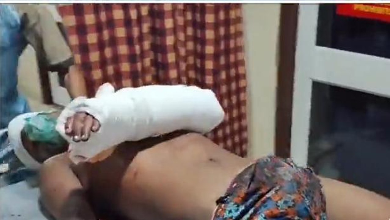 বীরভূমঃ বোমা ফেটে গুরুতর জখম স্কুল ছাত্র