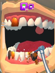 Dental surgery animation | Dailymotion channel